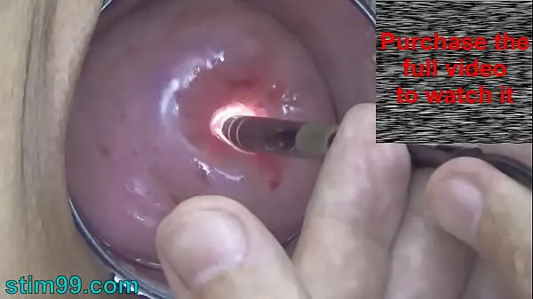 热Endoscope Camera inside Cervix Cam into Pussy Uterus酷视频