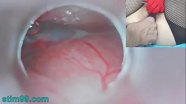 热Uncensored Japanese Insemination with Cum into Uterus and Endoscope Camera by Cervix to watch inside womb酷视频